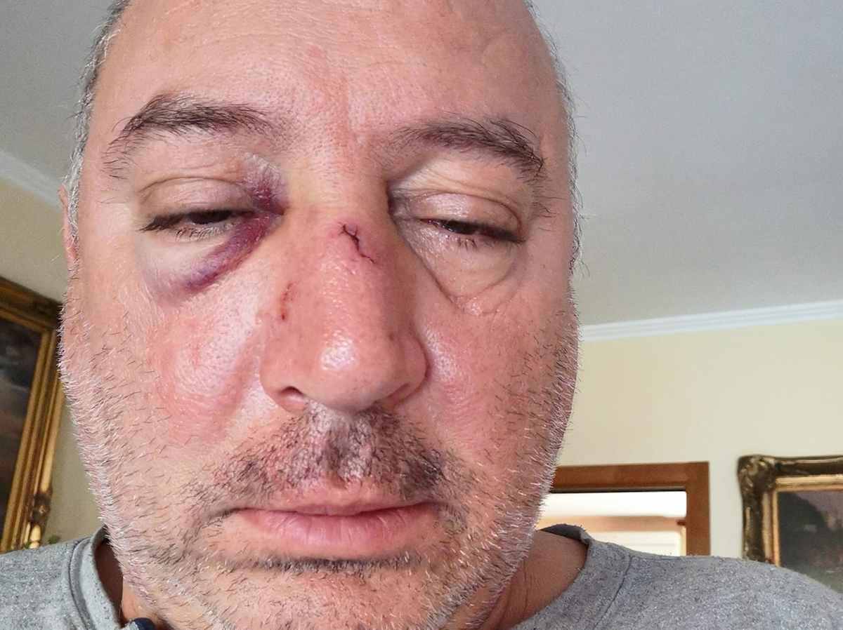 Foggia, in 4 pestano consigliere Massimiliano Di Fonso: aveva rimproverato un uomo che gettava rifiuti in strada