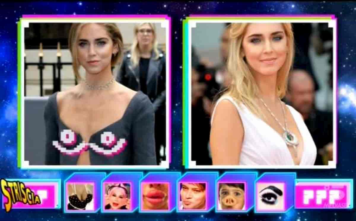 Striscia la Notizia: Chiara Ferragni rifatta? I dubbi dello Scanner Test su seno, zigomi e naso