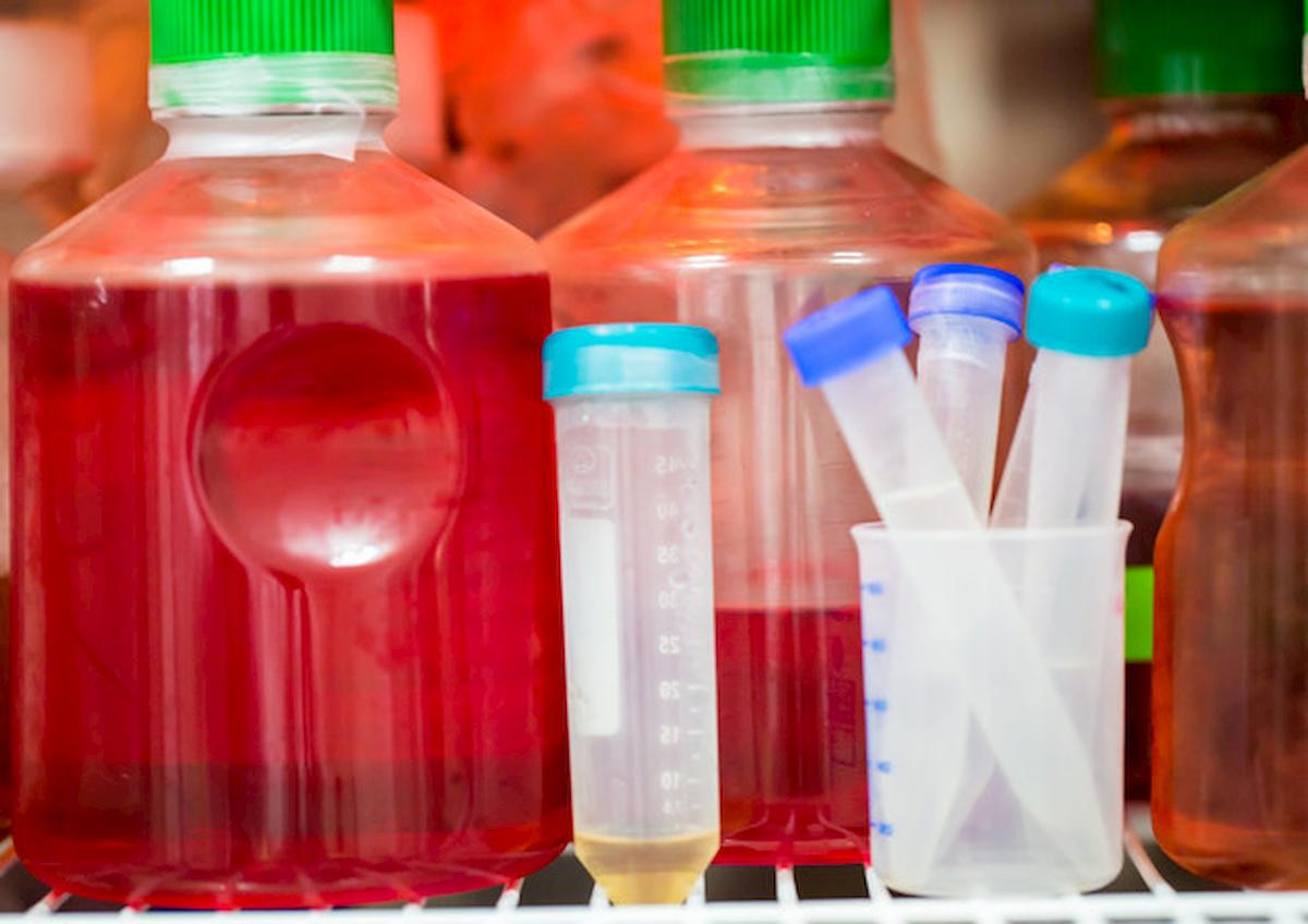 Gran Bretagna, pap test sarà sostituito da kit per esame urine da fare a casa