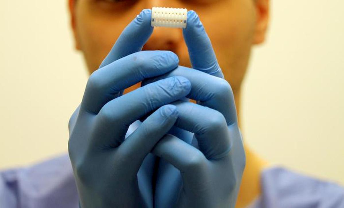 Bronco 3D riassorbibile stampato e impiantato al Bambin Gesù: bimbo di 5 anni torna a respirare