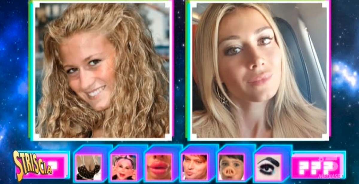 Diletta Leotta allo scanner test di Striscia: "Rifatti labbra, seno e naso"