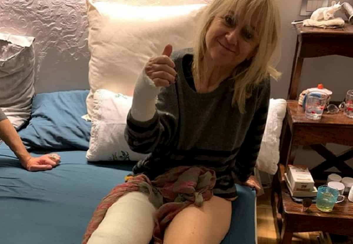 Luciana Littizzetto, foto col gesso postata su Instagram: rotula e polso rotti