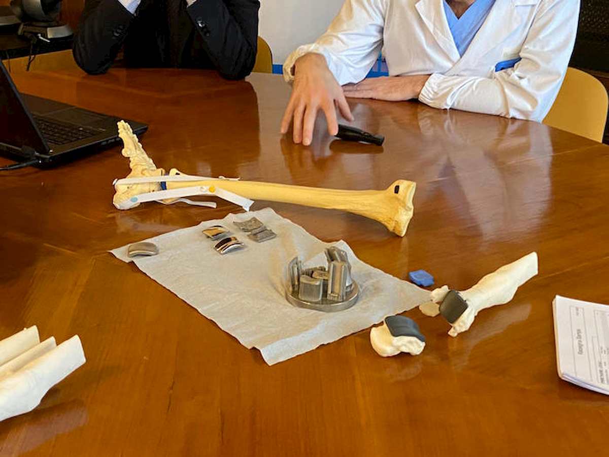 Bologna, intera caviglia ricostruita in 3D: è la prima volta al mondo