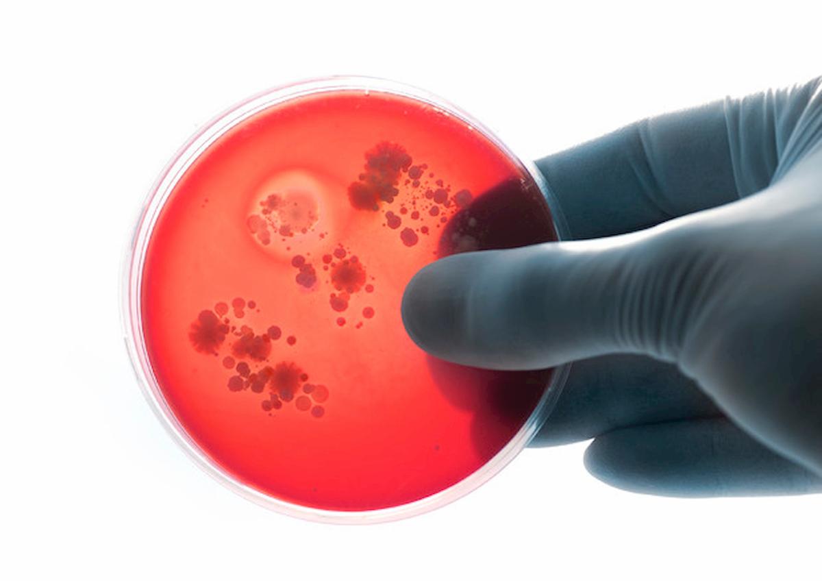 Meningite, Marzia Colosio muore a 48 anni come Veronica Cadei. Caccia al portatore sano di meningococco C