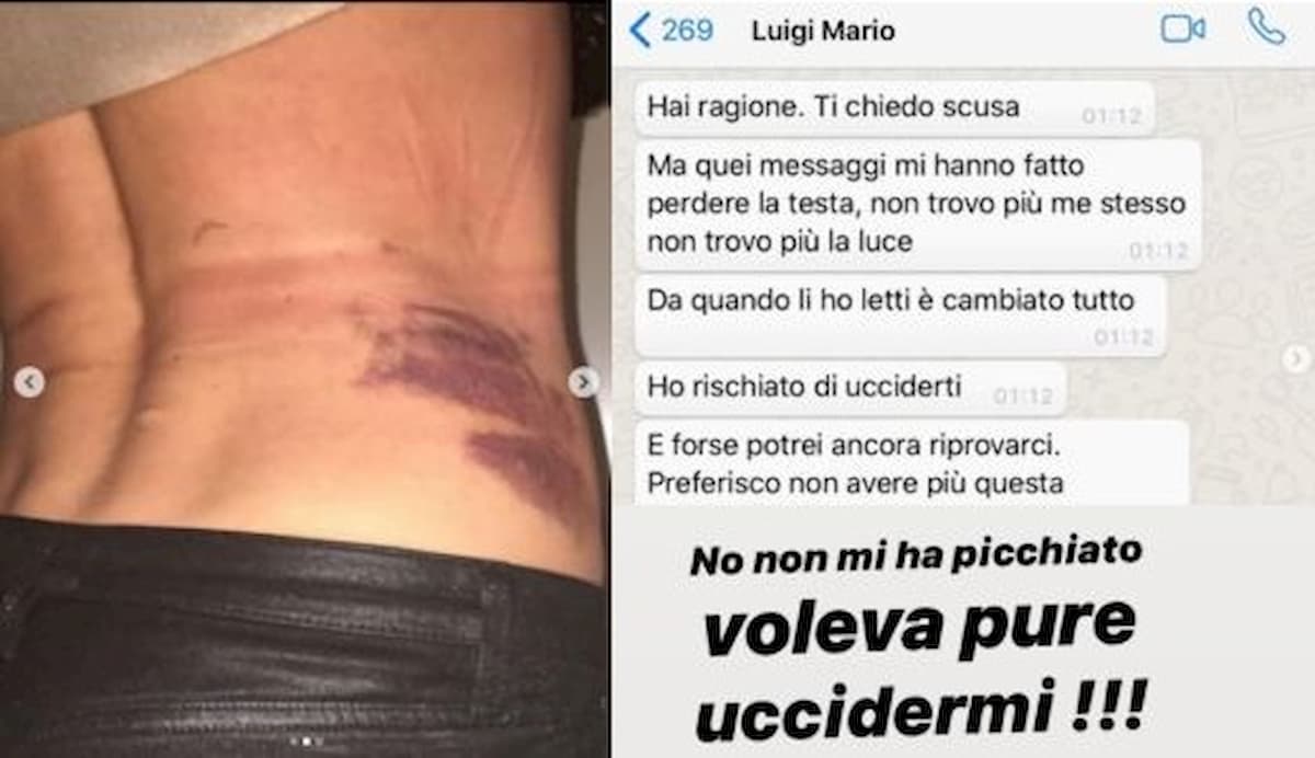 Nina Moric mostra i lividi e pubblica i messaggi di Luigi Favoloso: "Voleva uccidermi"
