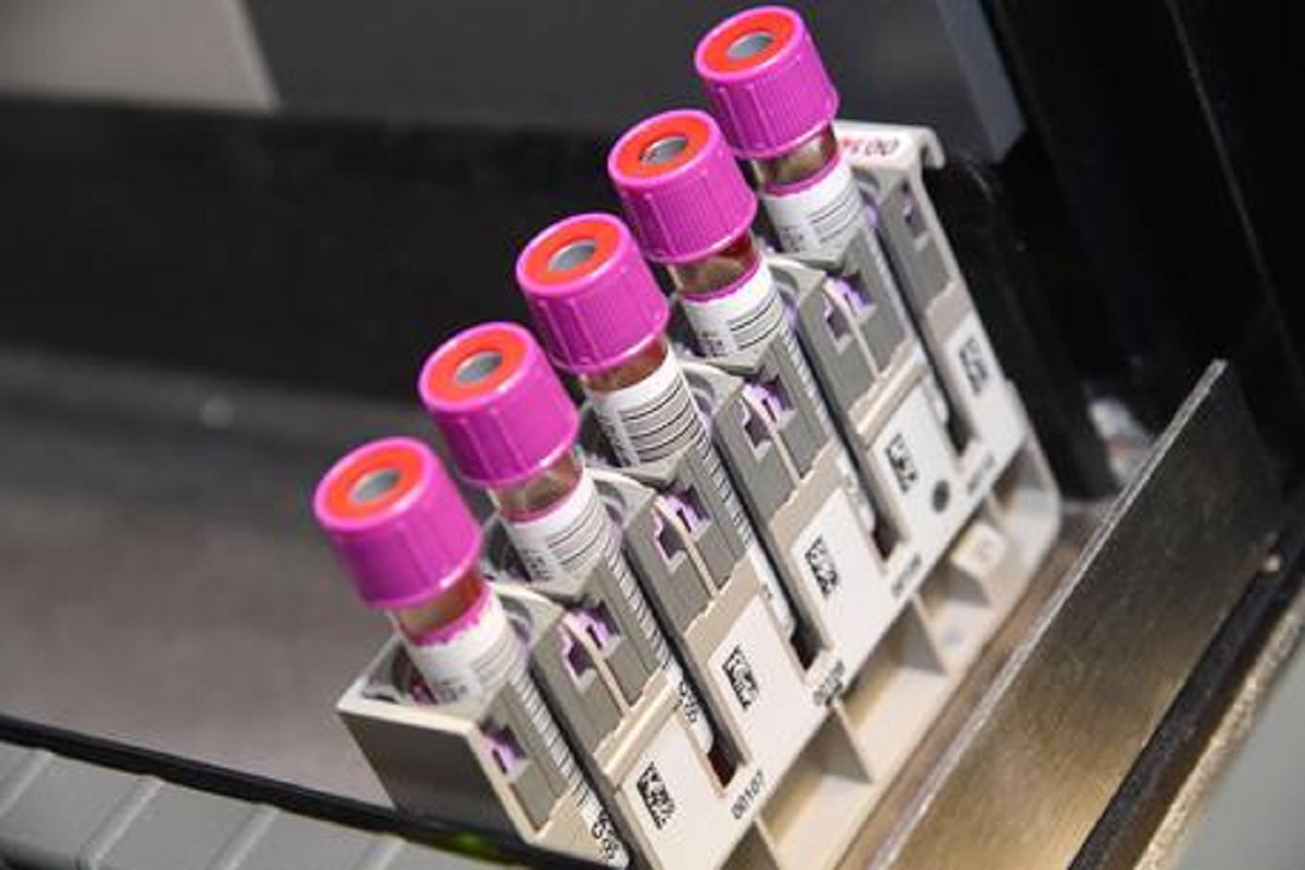 Misteriosa polmonite in Cina, allerta negli aeroporti. Si teme una nuova Sars