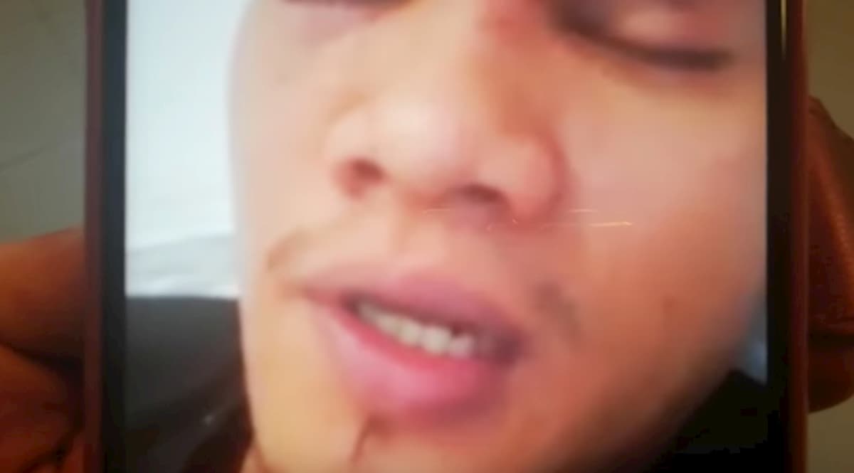 Cagliari, cameriere filippino pestato sul bus: pensavano fosse un cinese...