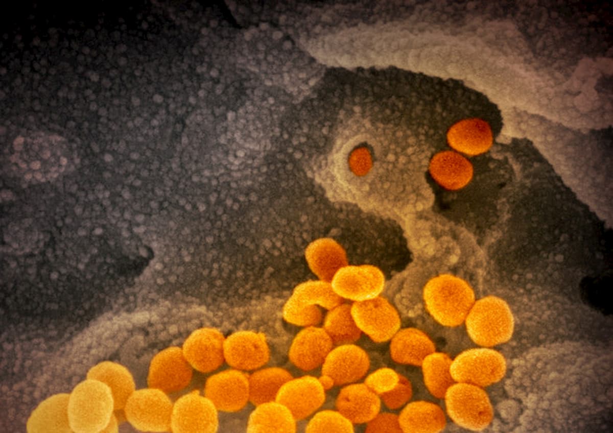 Coronavirus, l'influenza stagionale ne uccide di più? Il confronto