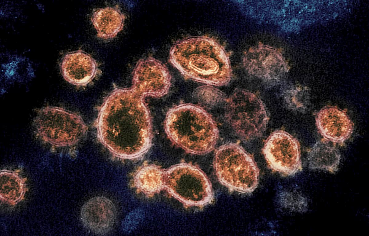 Coronavirus, la svolta: tamponi solo per chi ha i sintomi. Paziente zero? Se guarito non lo scopri più