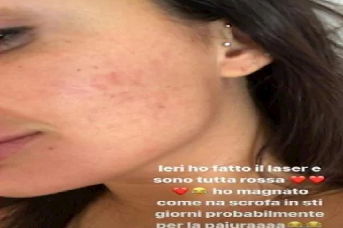 Elettra Lamborghini pelle rovinata