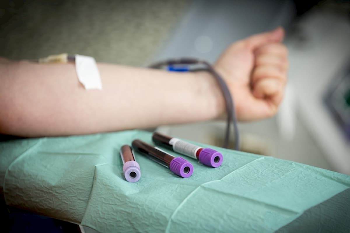 Donazioni di sangue in calo in tutta Italia, colpa del coronavirus