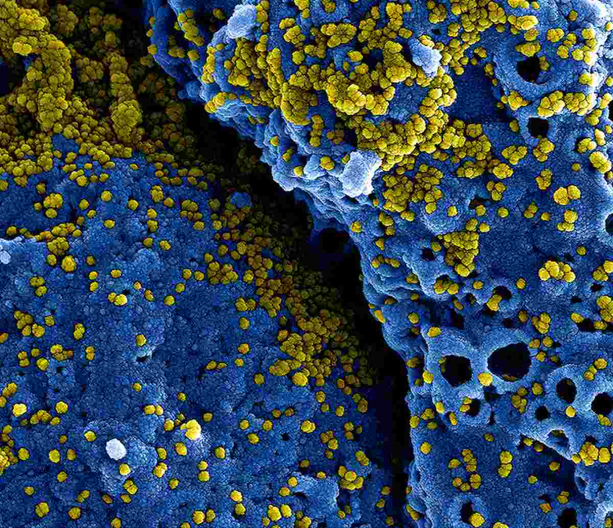 Coronavirus, ottenuti due farmaci specifici: attaccano l'enzima proteasi