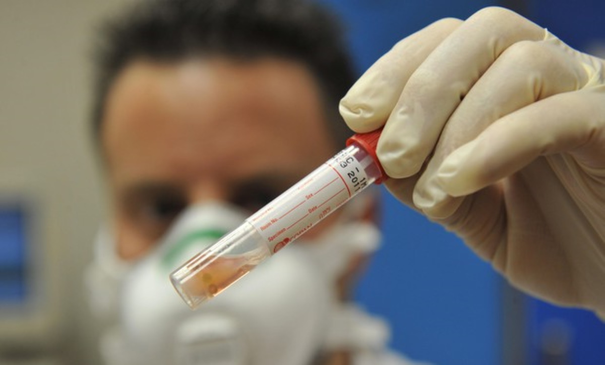 Coronavirus olfatto perso nell'80% dei pazienti, gusto alternato nell'88%