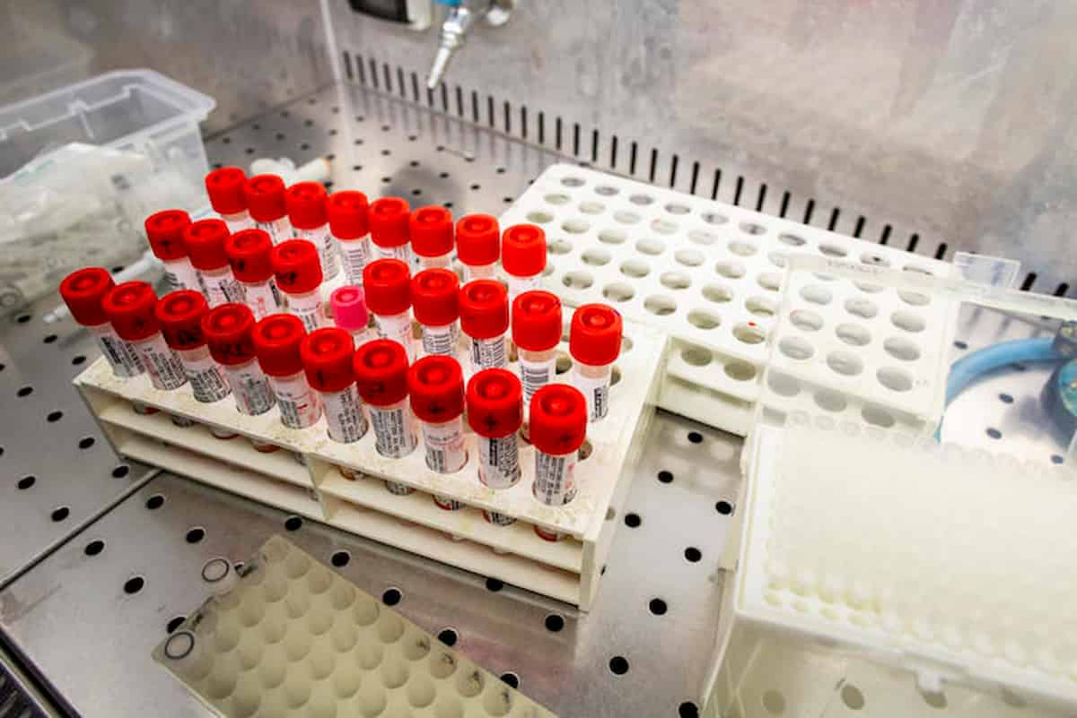 Coronavirus e vaccini. Test rapidi per sapere chi è immune, senza sapere se e quale immunità c'è