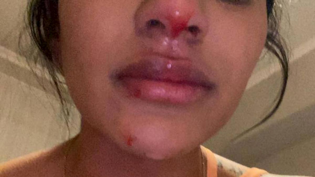 Boca, Villa nella bufera. La fidanzata Daniela Cortes: "Mi maltratta, sono terrorizzata"