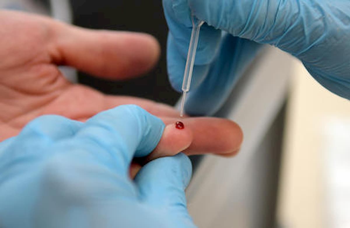 Coronavirus, in Lombardia da giovedì 23 al via i test sierologici