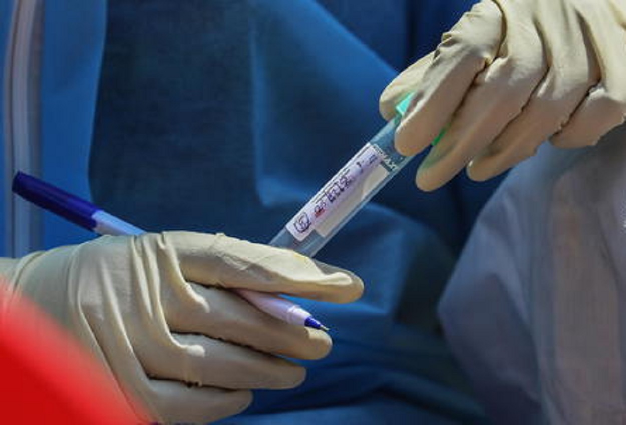 Test sierologici, Ansa