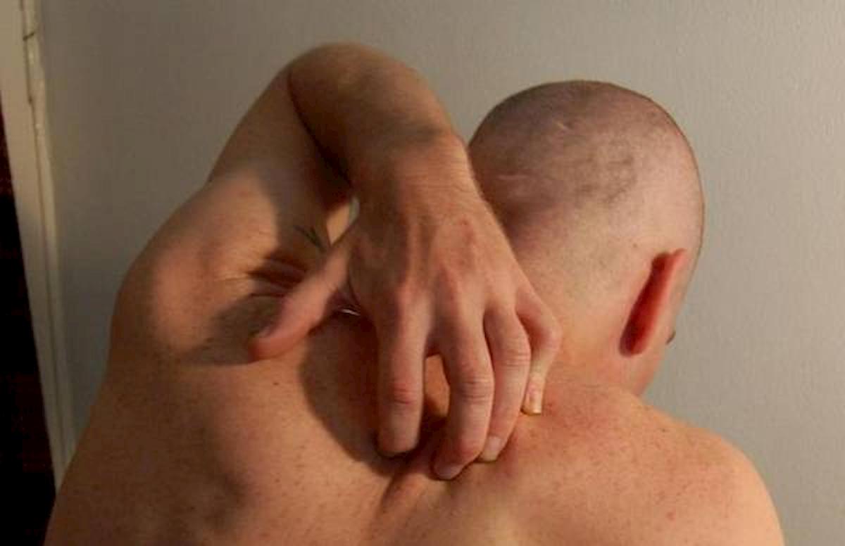 coronavirus problemi dermatologici