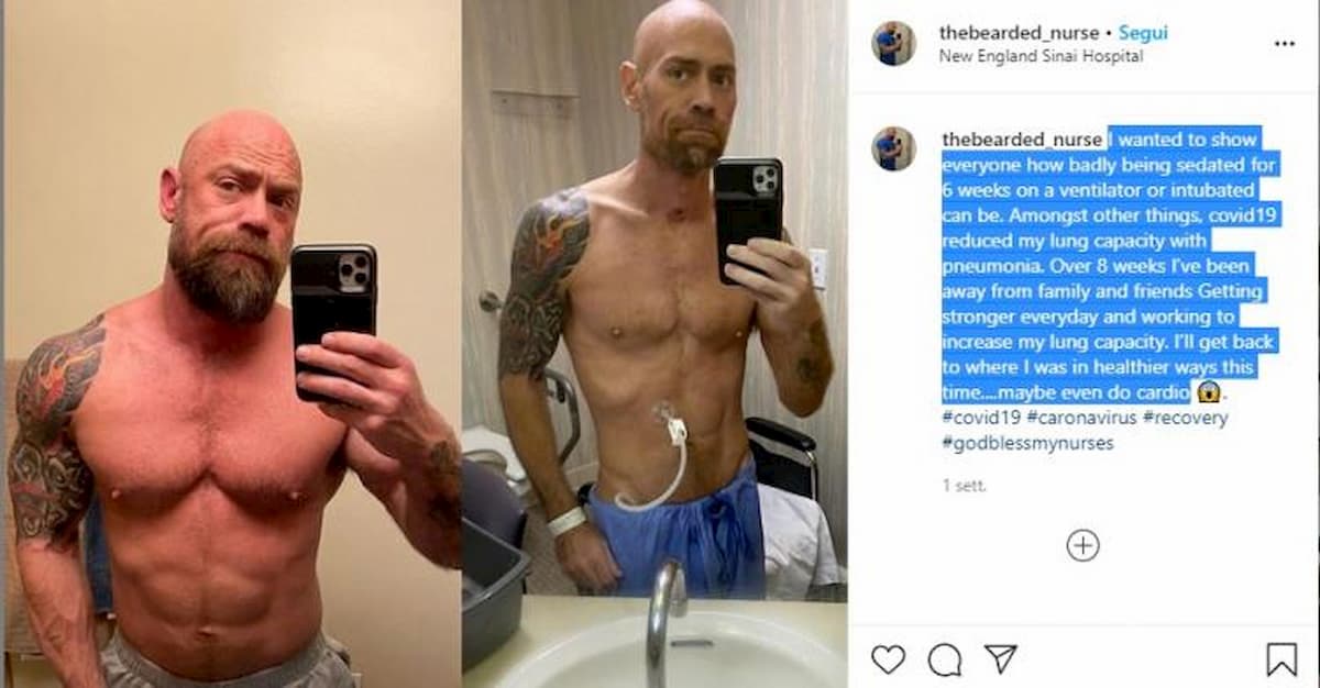 Coronavirus, prima e dopo FOTO Ecco quello che fa anche quando guarisci