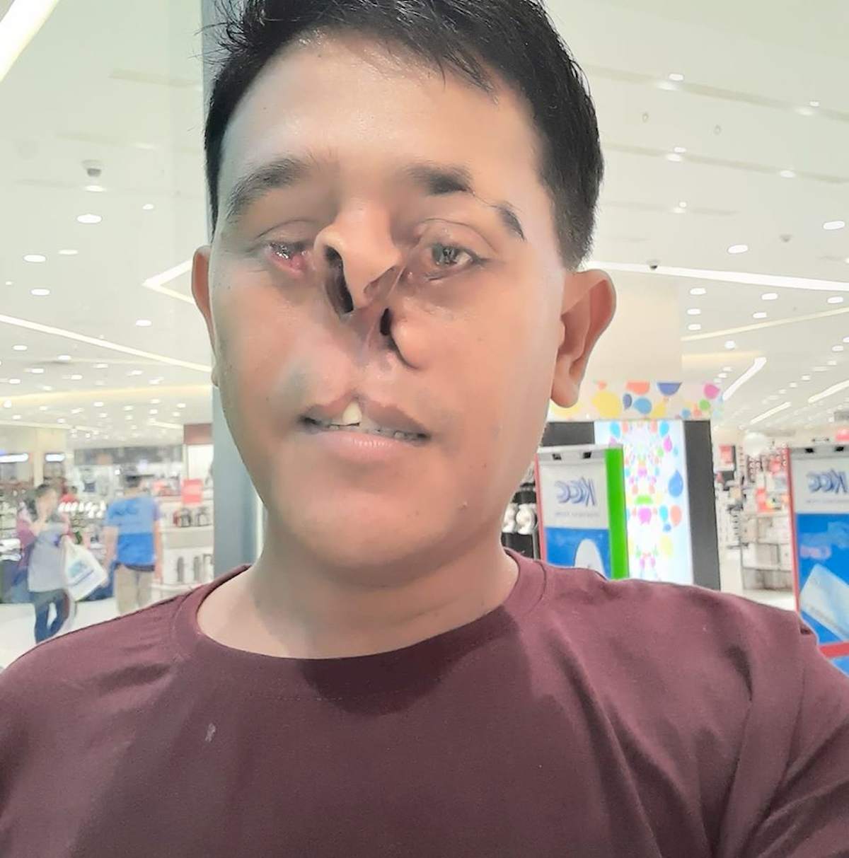 jilam samson filippine