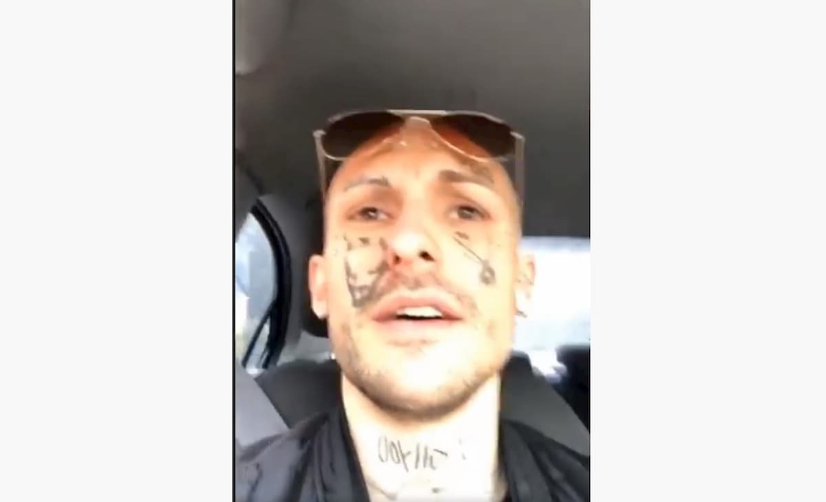 Il rapper 1727wrldstar, schianto in auto a 110 km/h: “Ho preso il muro fratellì”. Auto sequestrata e patente ritirata