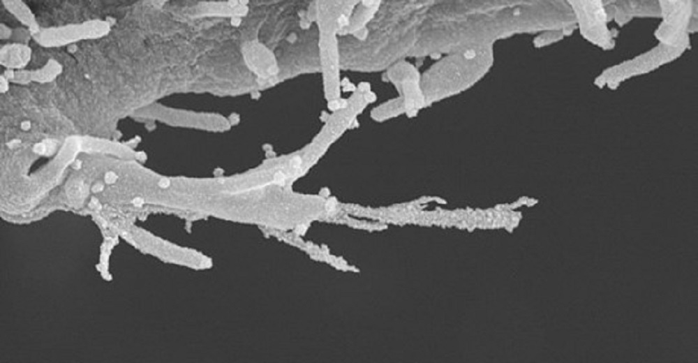 Coronavirus "zombifica" cellule e crea tentacoli per diffondersi nel corpo