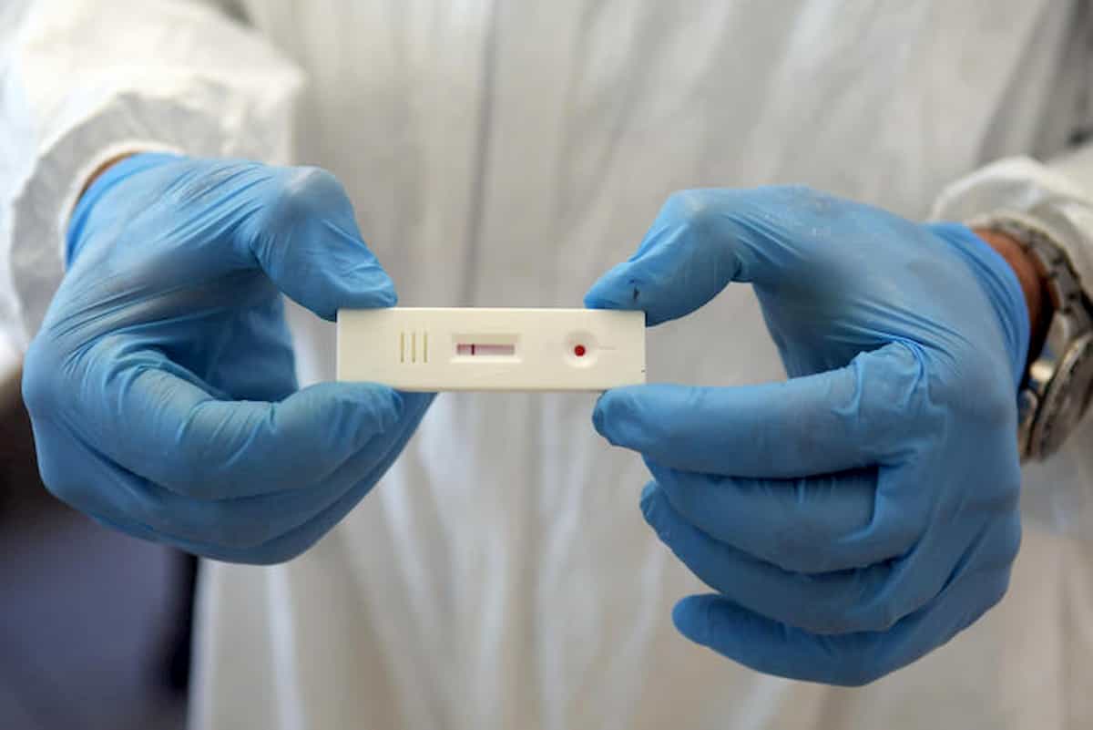 Coronavirus Italia, non è finita. Indice di contagio sopra 1 in Lazio, Lombardia, Emilia Romagna