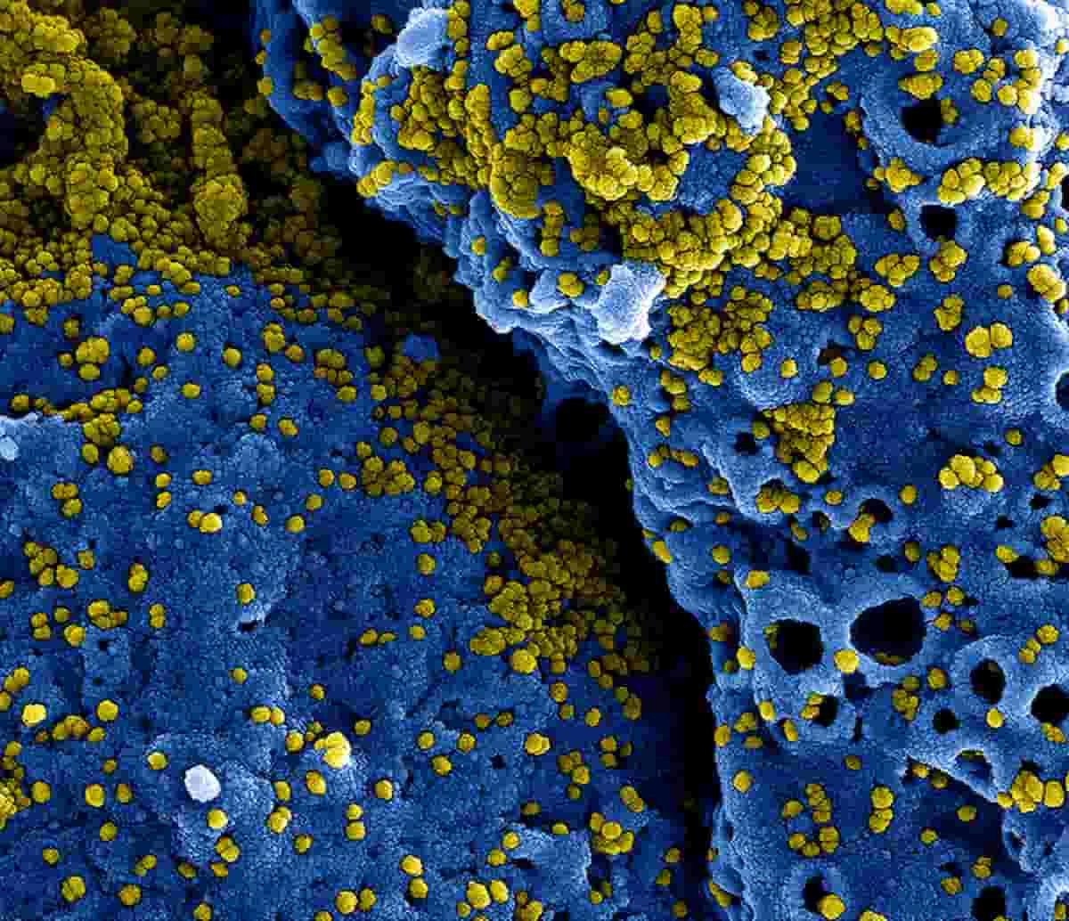 Asintomatici, di cosa parliamo? I dati scientifici: contagiano anche loro (ma non i portatori sani)