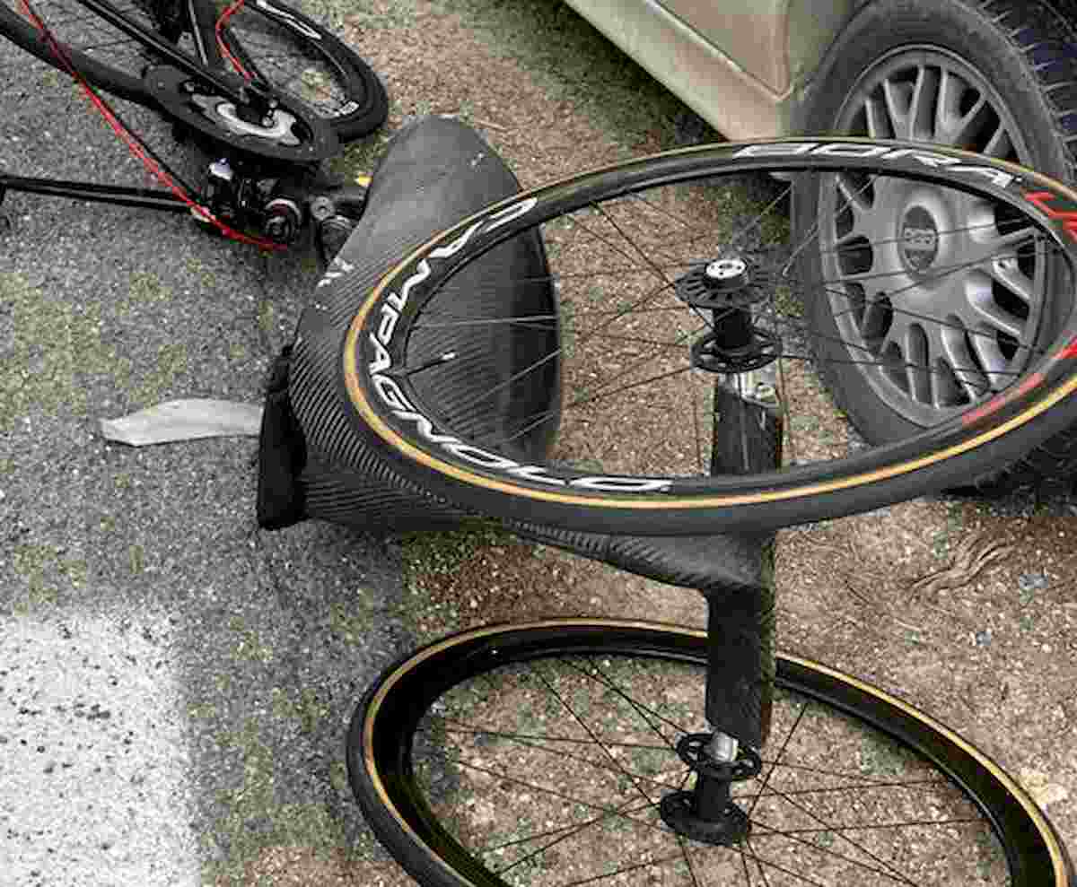 Alex Zanardi è stabile ma grave, possibili danni alla vista. I medici fiduciosi