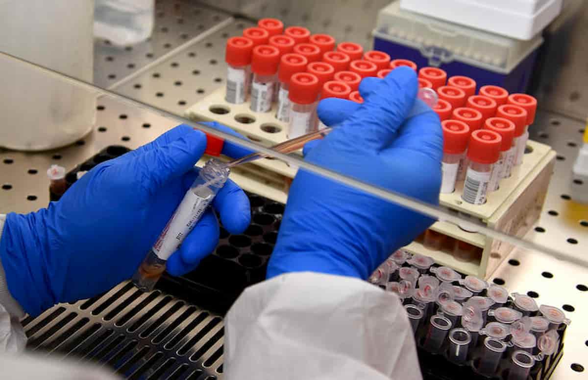 Coronavirus, Oms ritratta sugli "asintomatici non contagiano": "E' una grande incognita"