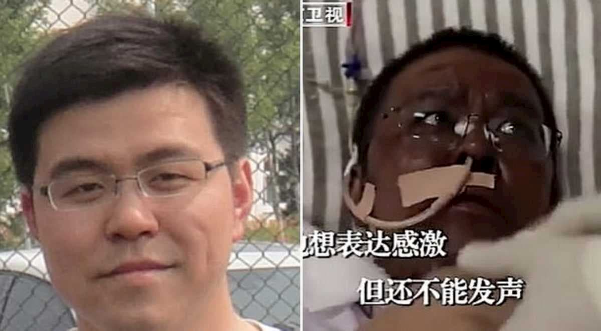 Wuhan, morto il medico la cui pelle diventò nera per la cura contro il coronavirus