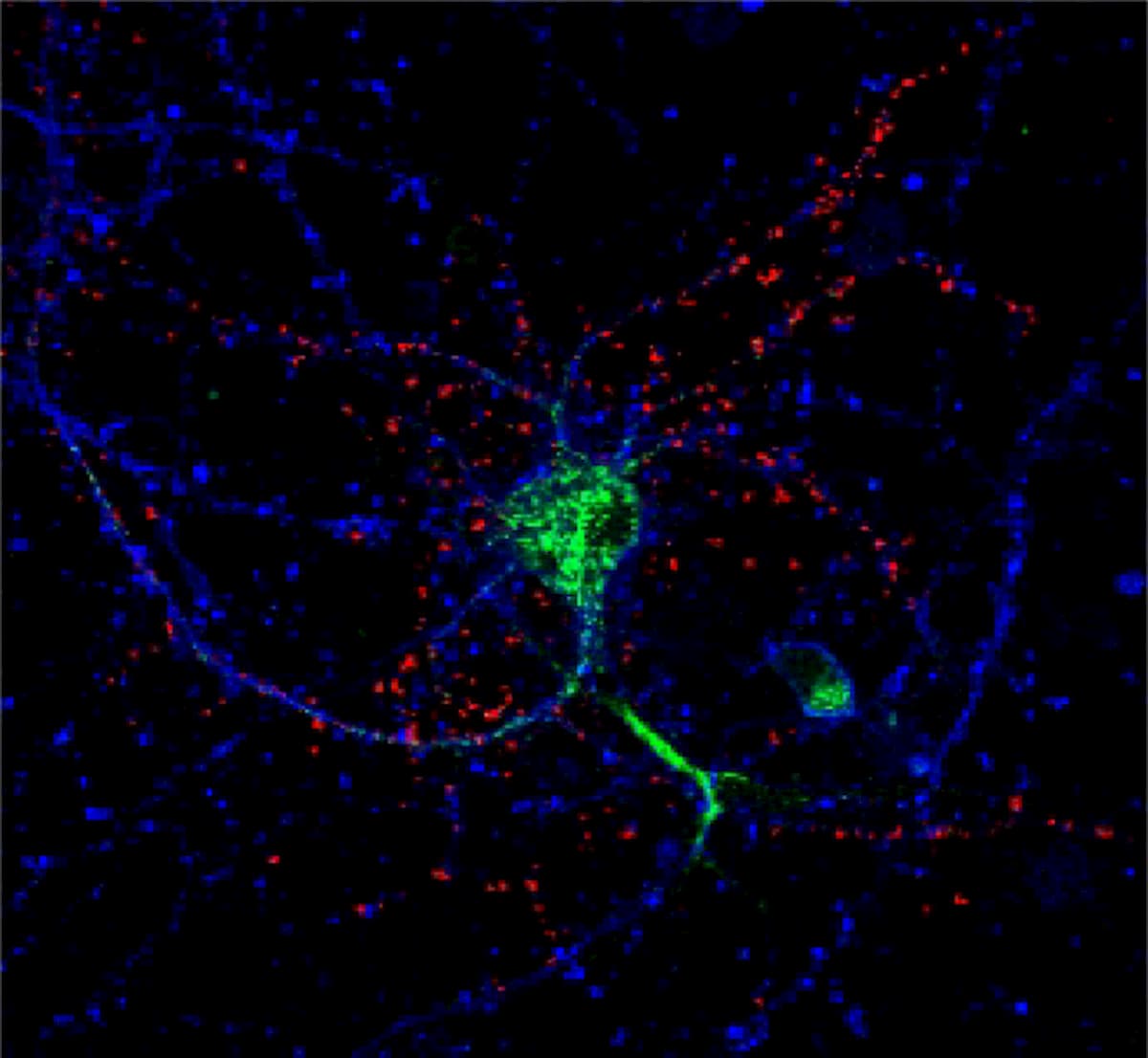 E' stata messa a punto in Italia la prima protesi liquida della retina
