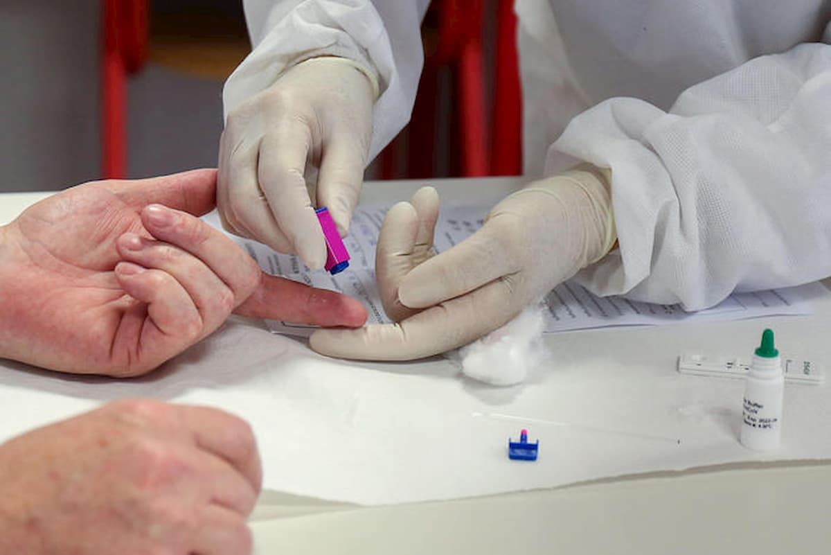 Super anticorpi: identificati i più efficaci