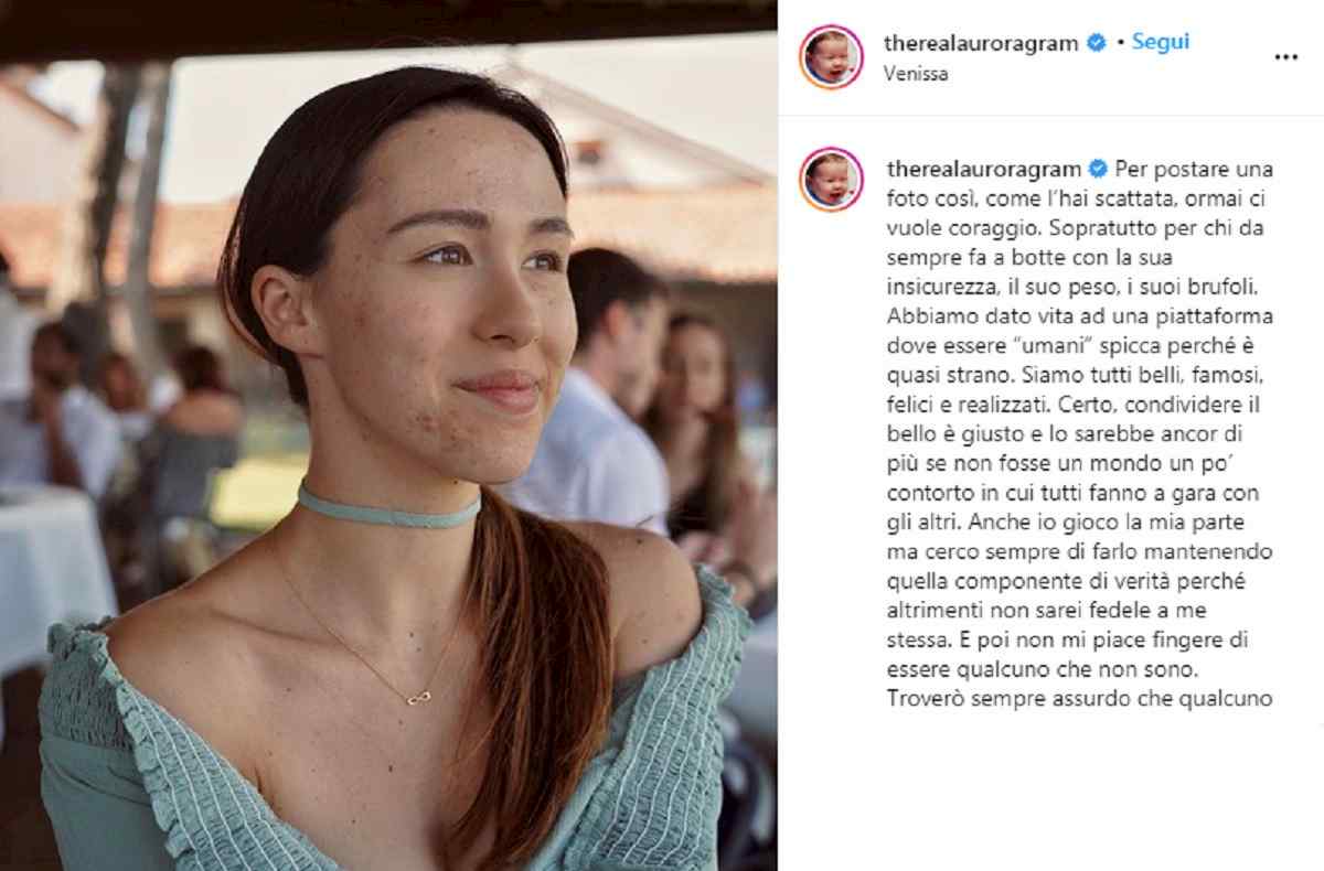 aurora ramazzotti con i brufoli