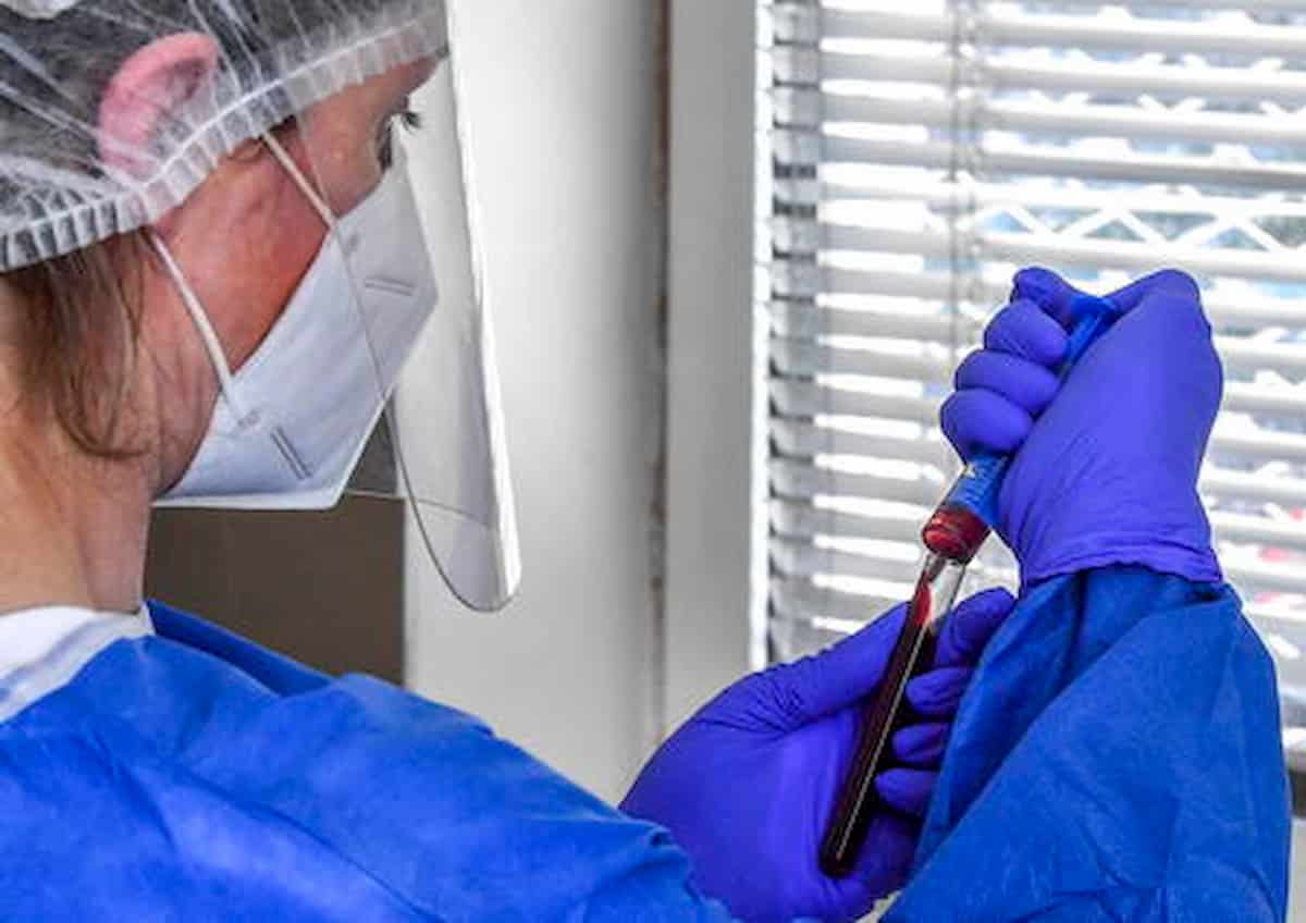 Roma, chiuso negozio di ottica