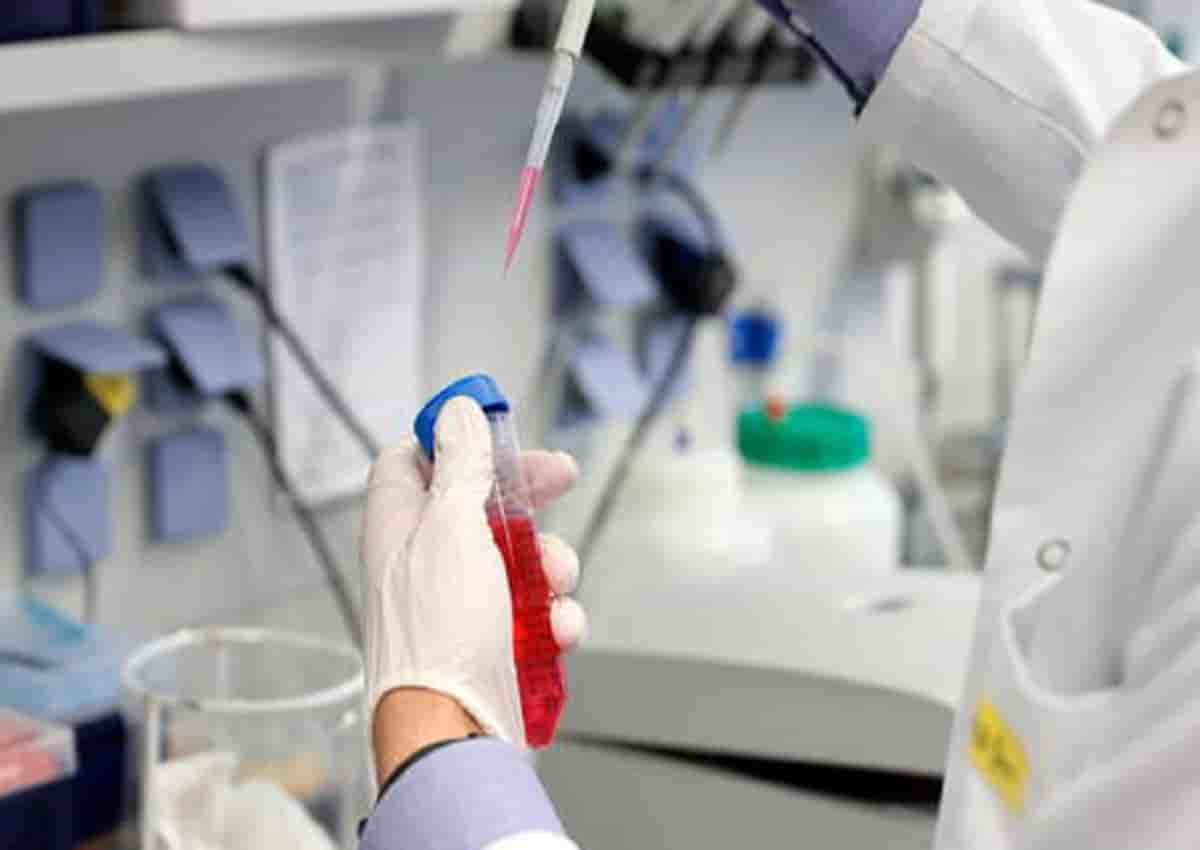 Coronavirus Modena, foto d'archivio Ansa