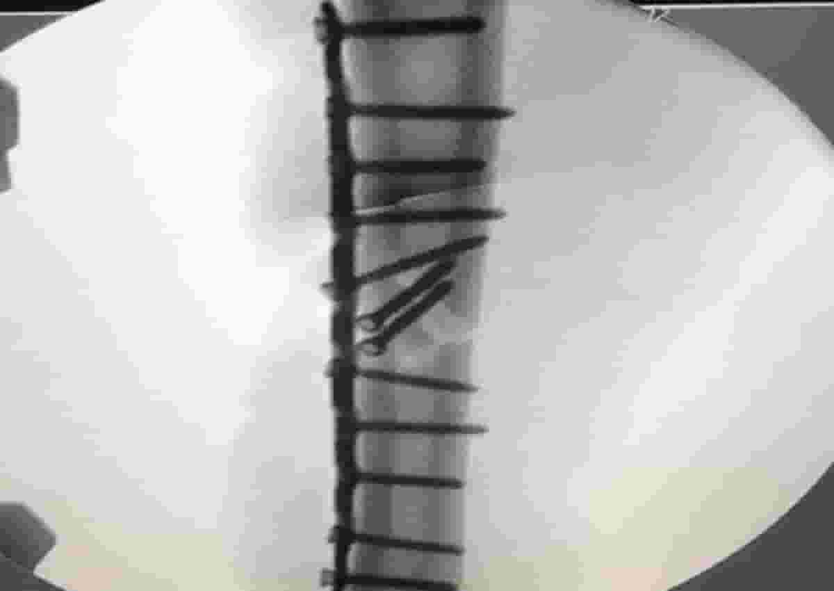 Marc Marquez, la radiografia