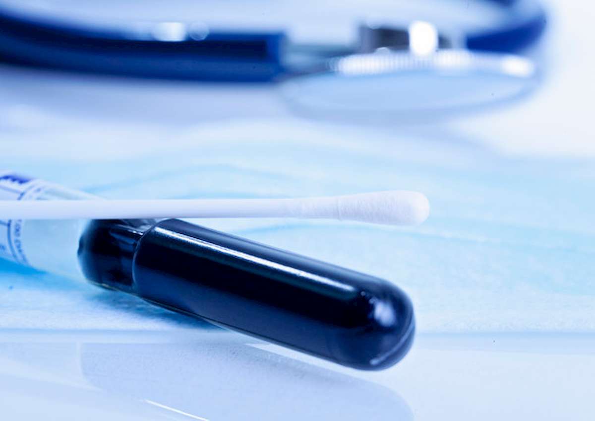 Pap test può scoprire anche tumore ovaio fino a 6 anni prima