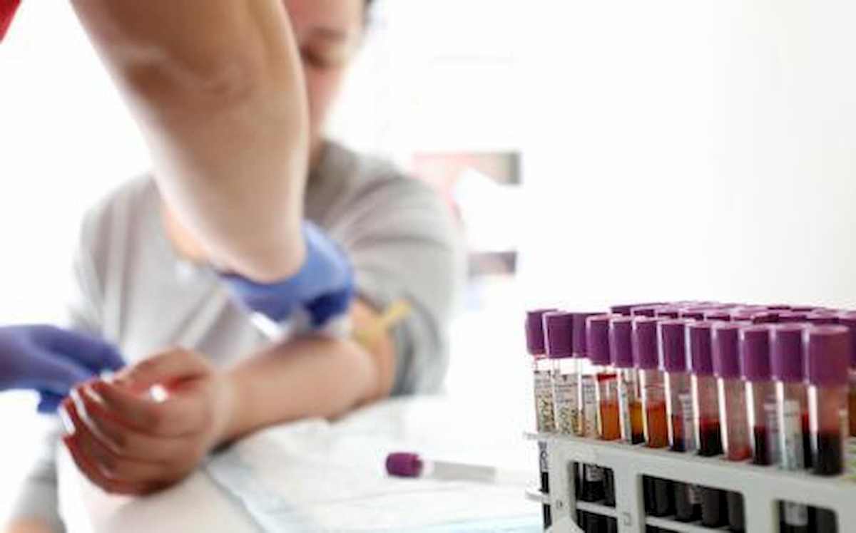 PanSeer, test del sangue rivela 5 forme di tumore fino a 4 anni prima