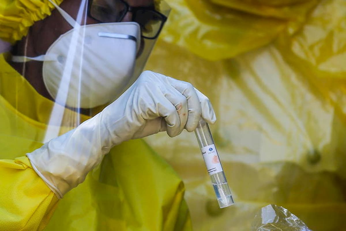 Test sierologici, meno della metà risponde