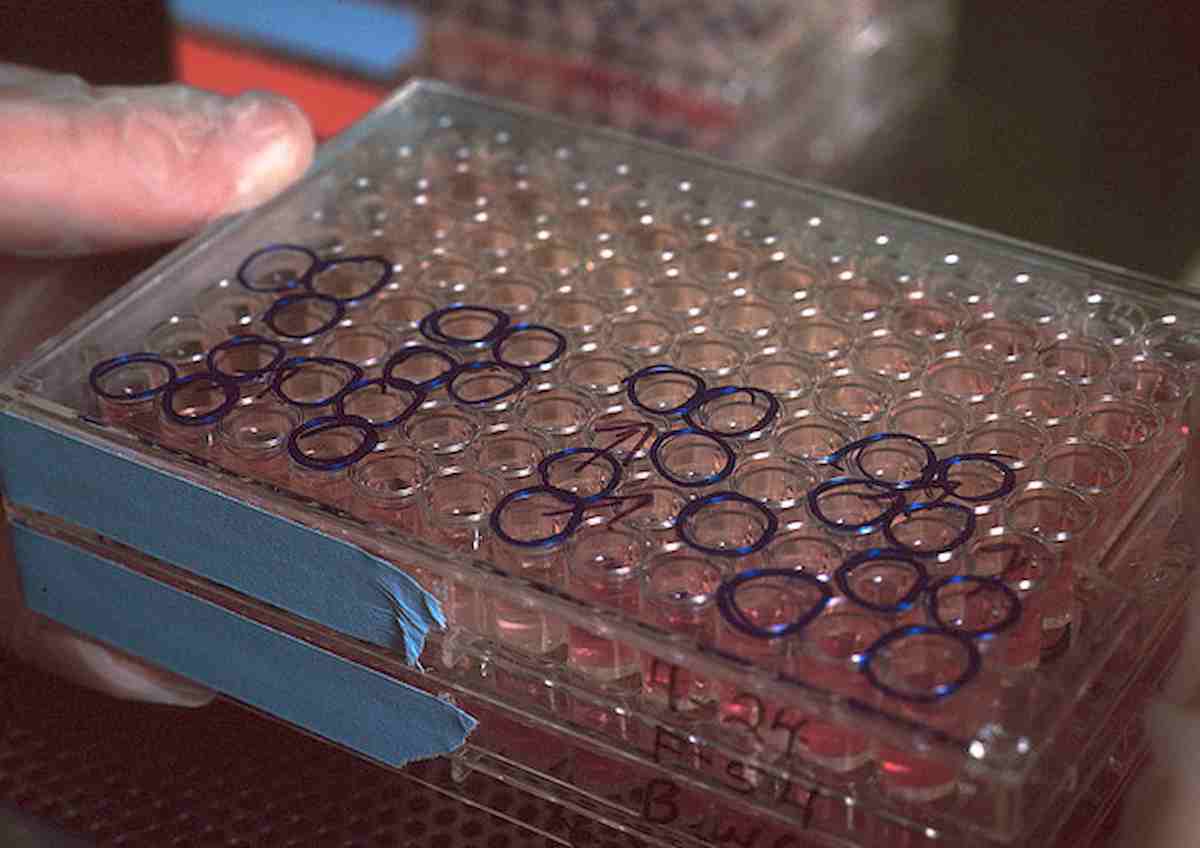 Anticorpi super: una iniezione proteggerà per sei mesi dal coronavirus