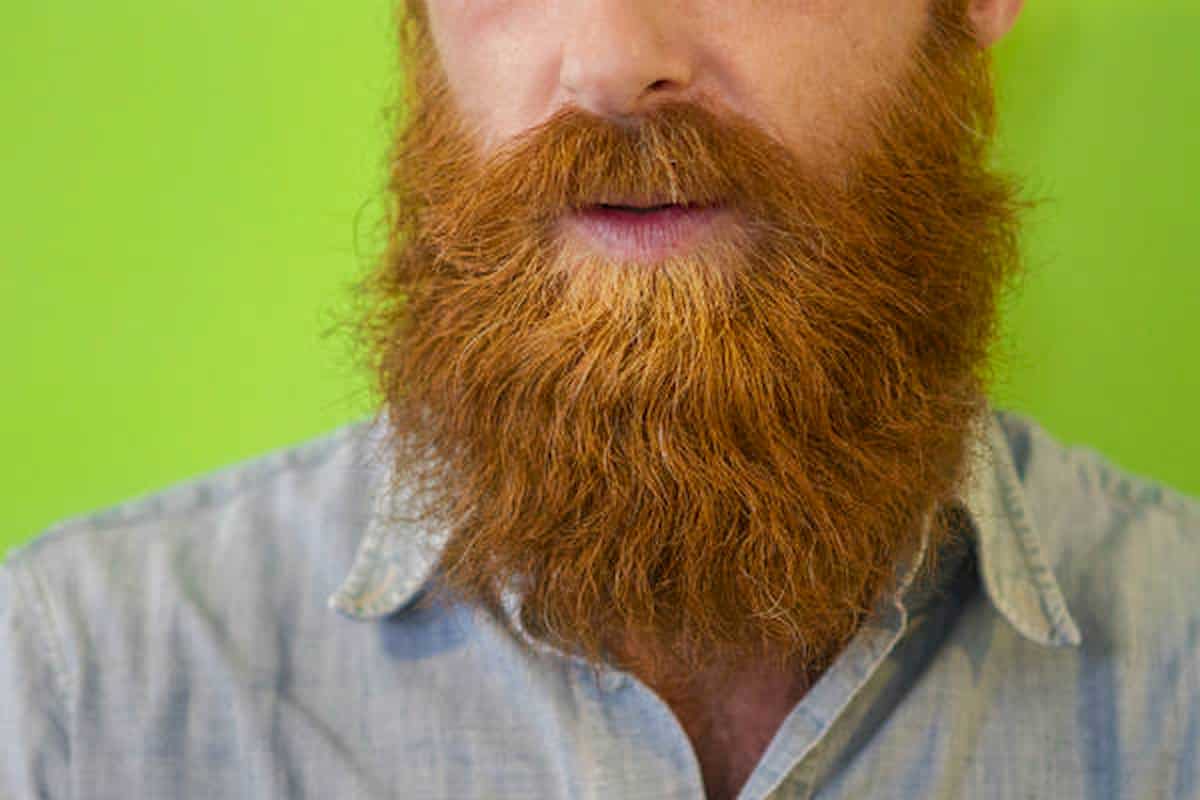 Sindrome dell'ovaio policistico: ragazza si lascia crescere la barba