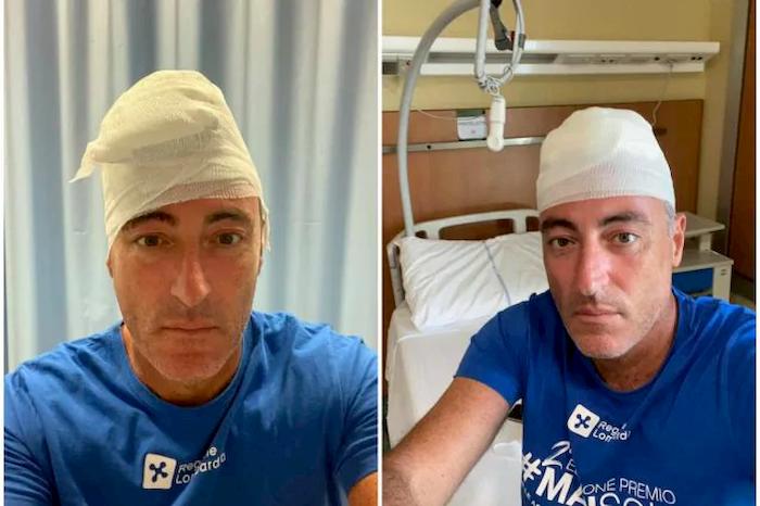 Giulio Gallera batte il capo durante partita di paddle: 30 punti in testa