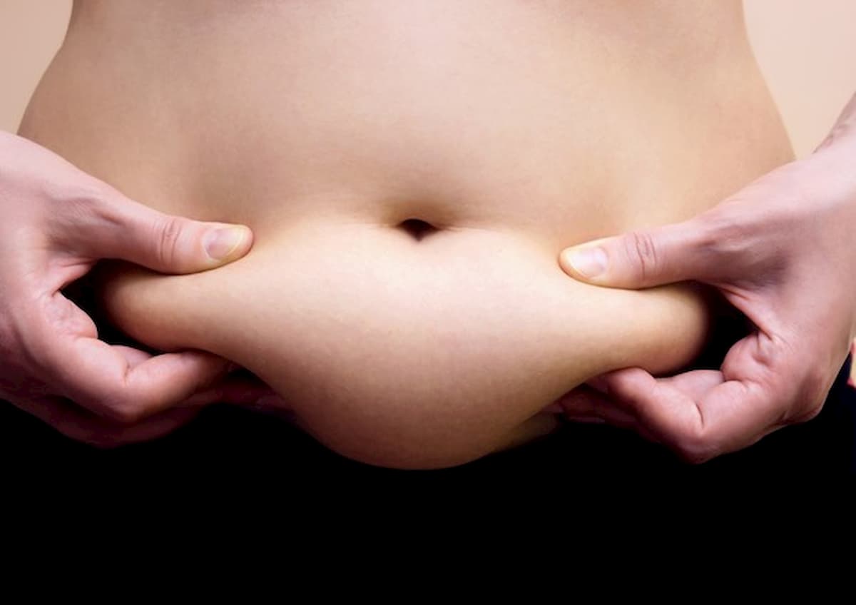 Obesità aumenta il rischio di morte da Covid del 48%