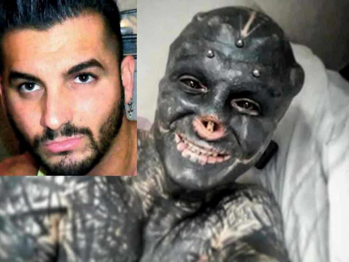 Anthony Loffredo si fa rimuovere il naso e orecchie per trasformarsi in alieno