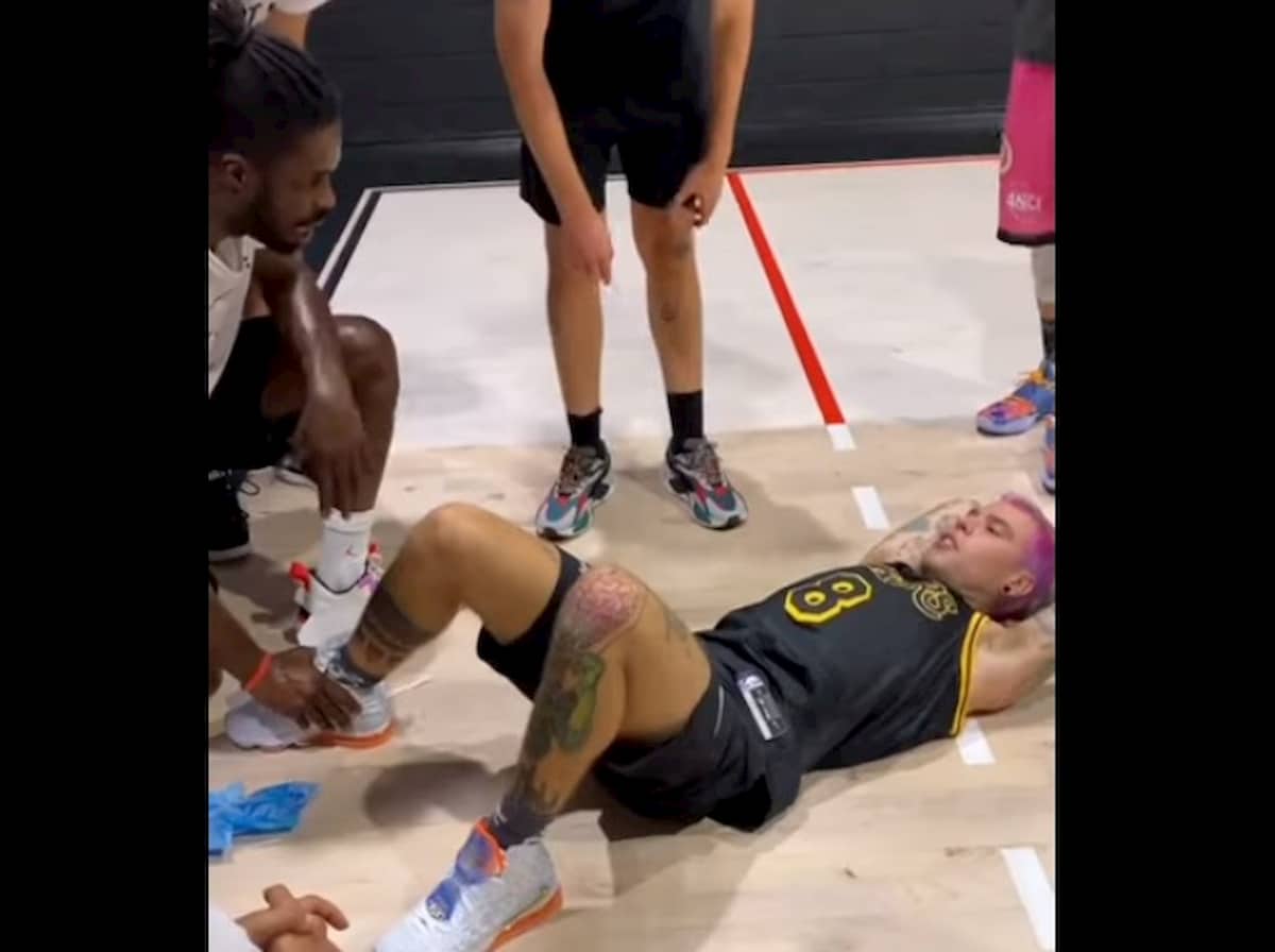 Fedez si rompe il legamento della caviglia