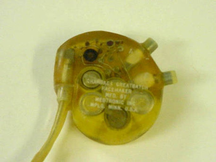 Bambin Gesù, pacemaker impiantato al contrario: muore bimbo 2 anni. 8 medici indagati