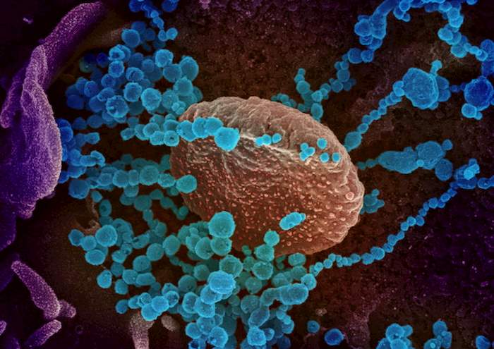 Mis-C, scoperta la malattia infiammatoria nei bimbi Covid scambiata per Kawasaki