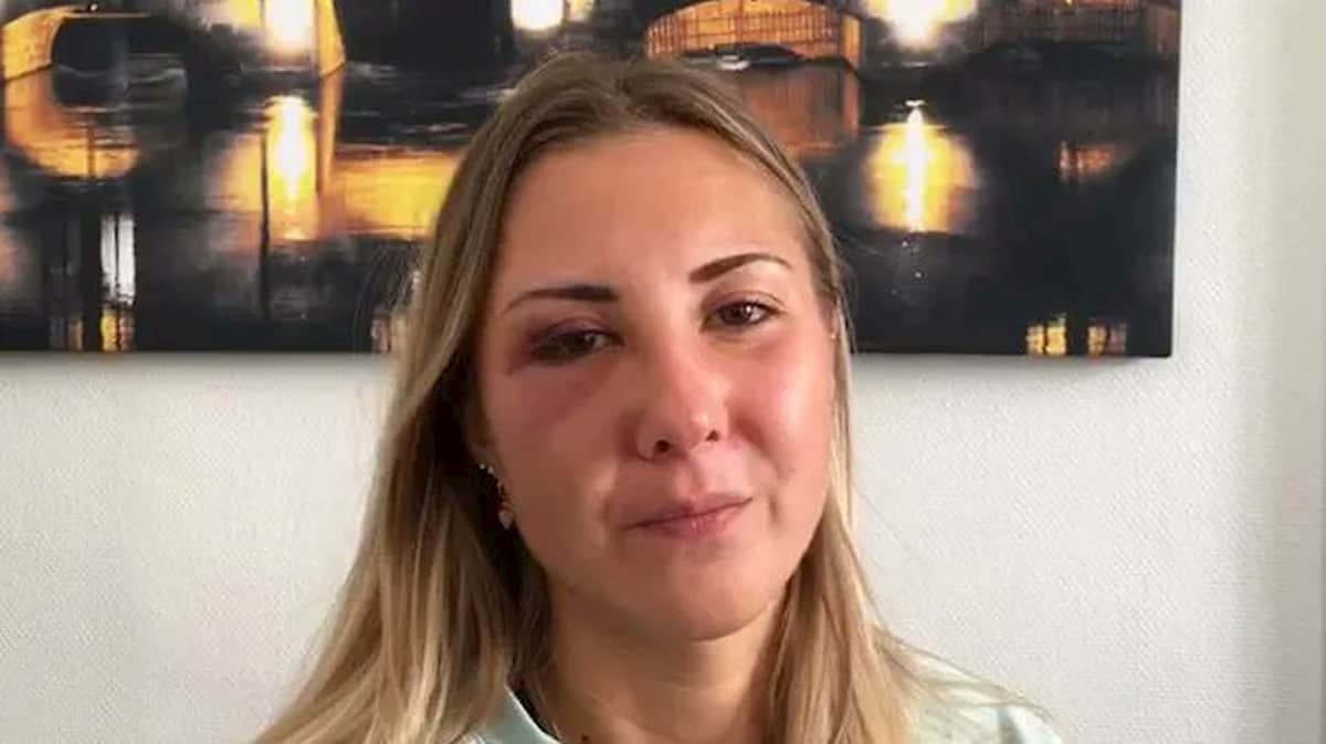 Studentessa picchiata in strada a Strasburgo perché indossava gonna