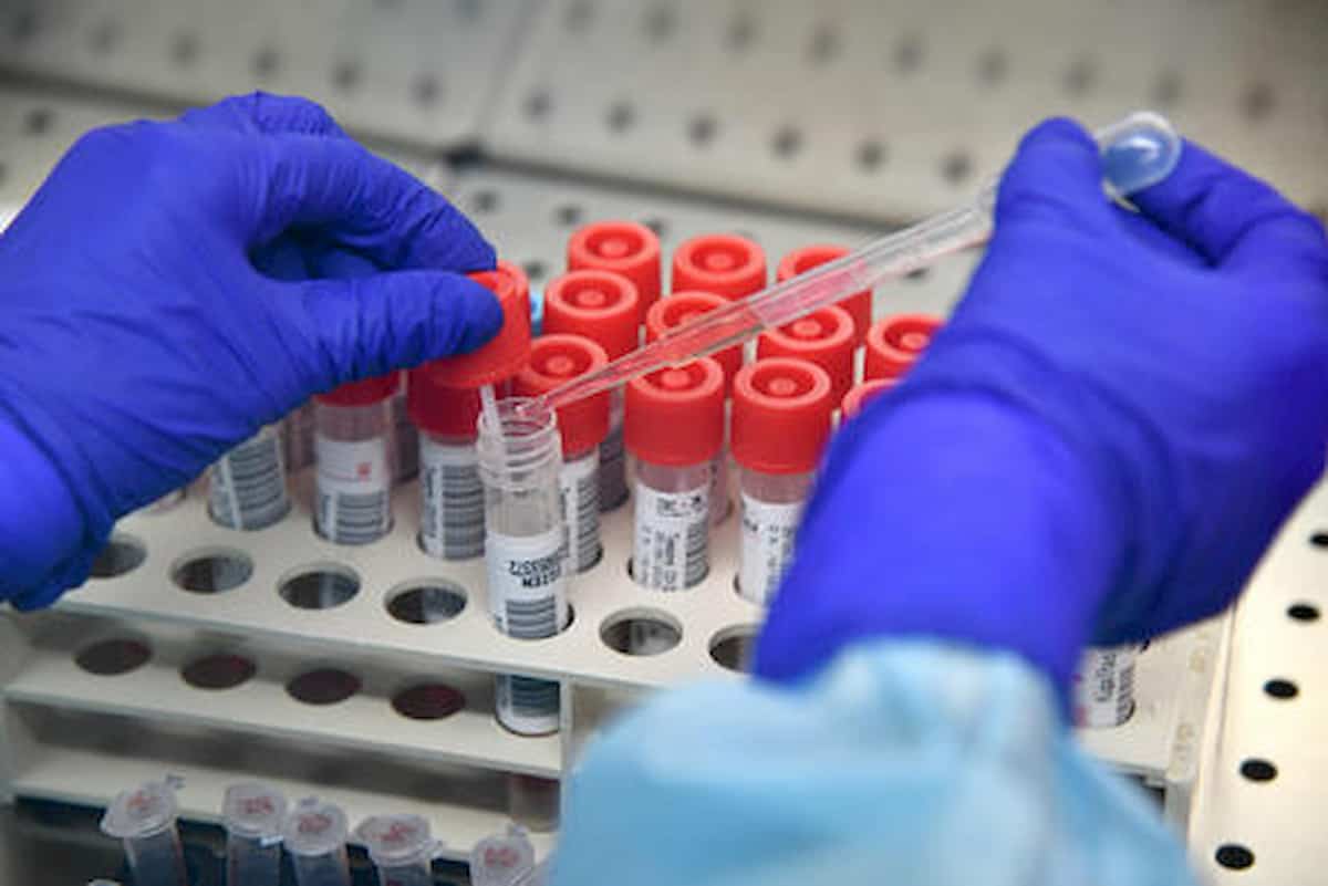 Anticorpo monoclonale più forte contro il Coronavirus. Lo hanno scoperto in un laboratorio di Siena